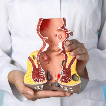 Piles Treatment
